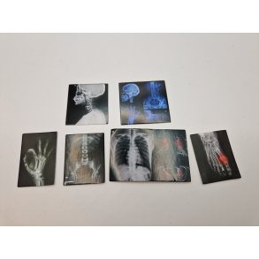 Røntgen billeder og andre læge billeder